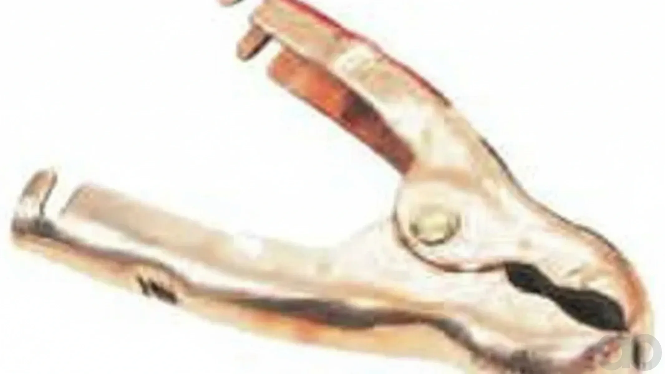 Case IH - ZQC602072001 - Clamp